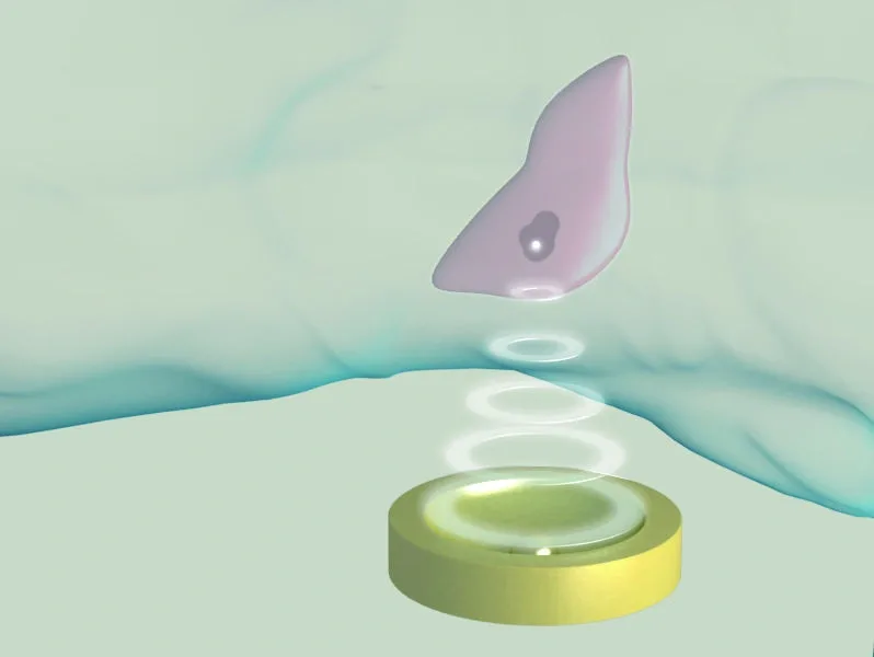 ภาพแสดง transducer และการรวมคลื่นอัลตราซาวนด์ที่เนื้อเยื่อเป้าหมาย